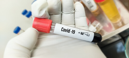 Wall Mural - Blood sample tube positive with COVID-19 virus or novel coronavirus 2019 found in Wuhan, China