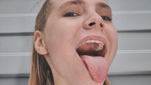 The Young Girl Opens Her Mouth And Shows Her Tongue. Stamatology Theme.