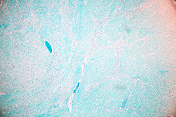 Cerebellum, Thalamus, Medulla oblongata, Spinal cord and Motor Neuron human under the microscope in Lab.
