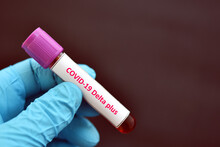 Delta Plus COVID-19 Positive, Blood Sample Positive With Delta Plus Variant Of COVID-19 Coronavirus