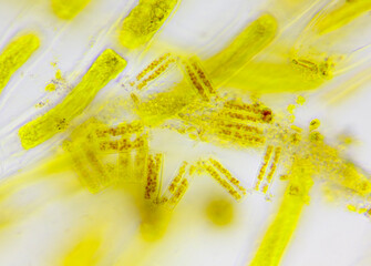 Wall Mural - Microscopic view of a diatoms (Diatoma) between algae cells. Brightfield illumination.