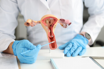 Gynecologist holds urogenital cytobrushes and model of female reproductive system