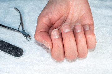 Wall Mural - Close-up of a Caucasian female hand with natural unpolished nails, overgrown cuticles, tweezers and a nail file