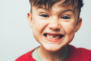 Portrait of a child with an open mouth a tooth fell out