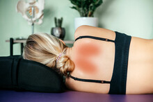 A Female Patient Lying On Massage Table And Suffering From Scapular Pain In The Osteopathy Office