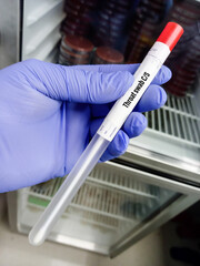 Sticker - Sterile swab stick in tube with throat swab sample for Throat swab culture and sensitivity test