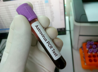 Sticker - Laboratory scientist hold blood sample with blur background for Astrovirus PCR test, health and medical concept