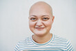 Happy bald girl smiling in front of camera - Focus on eyes