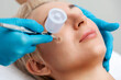 © _KUBE_ - Professional cosmetologist does a gas-liquid peeling procedure of the client's face. Close up. Side view. The concept of cosmetology and aesthetic medicine