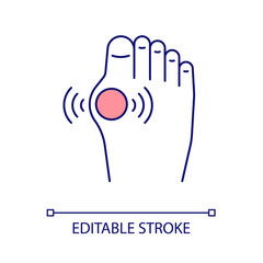 Poster - Feet arthritis RGB color icon. Inflammation in foot and toes. Joint disorder. Arthritis and arthrosis. Traumas. Isolated vector illustration. Simple filled line drawing. Editable stroke