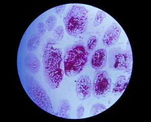 Gram staining, also known as Gram's method, is a method of differentiating bacterial species into two large groups (Gram-positive and Gram-negative). Here, Occasinal gram positive cocci are seen. 40X