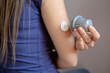 Close-up of girl applying flash glucose monitoring patch on her arm