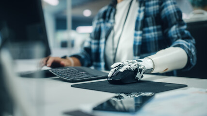 Aufkleber - Inclusive Office: Person with Disability Using Prosthetic Arm to Work on Computer. Professional with Advanced Thought Controlled Body Powered Myoelectric Bionic Limb to Control Mouse. Focus on Hands