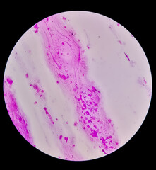 Wall Mural - Gram staining, also called Gram's method, is a method of differentiating bacterial species into two large groups (Gram-positive and Gram-negative).