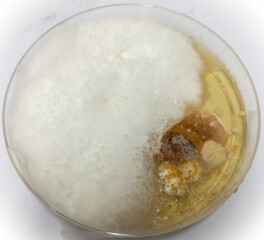 Poster - Fungus culture, Trichophyton spp, on Sabouraud dextrose agar (SDA), 21 day incubated at 28-30 °C