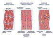 Muscle tissue with smooth, striated and cardiac examples outline diagram. Labeled educational medical structure with description and side view vector illustration. Anatomical and structural difference