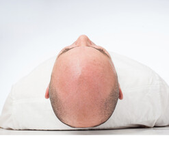 Hairless man in white studio