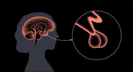 Wall Mural - Pituitary gland anatomy