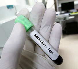 Poster - Blood sample for Ketamine test at medical laboratory