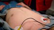 © stockbusters - Closeup paramedic hands putting holter electrodes on man body