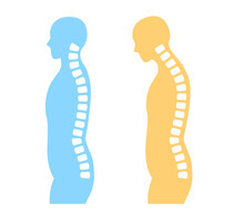Hunchback And Spine Posture Human Body Silhouette