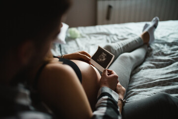 Wall Mural - Young pregnant couple looking at the ultrasound image