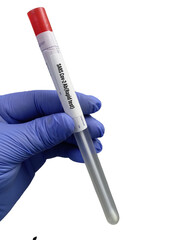 Poster - Throat swab sample for SARS Cov-2 Antibody(Rapid test), RT-PCR test sample