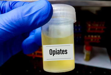 Poster - Medical laboratory urine container with urine sample for drugs test opiates. Diagnosis of illegal drug opiates in urine.