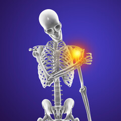 Sticker - Human skeleton with shoulder pain