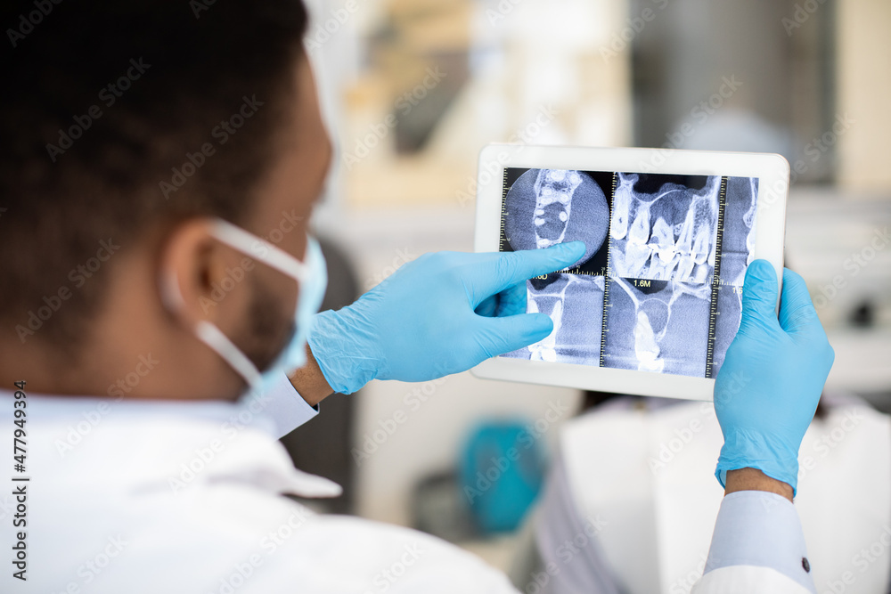 Male Black Dentist Doctor Checking Teeth Xray Picture On Digital Tablet