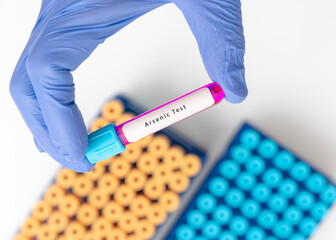 Wall Mural - Biochemistry Blood sample for Arsenic test