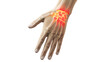 © Sebastian Kaulitzki - 3d rendered illustration of a painful wrist