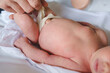 © Miljan Živković - Hands of unknown man father caring for umbilical cord with clamp and bandage of newborn baby neonatal care parent clean navel of baby on bed at home
