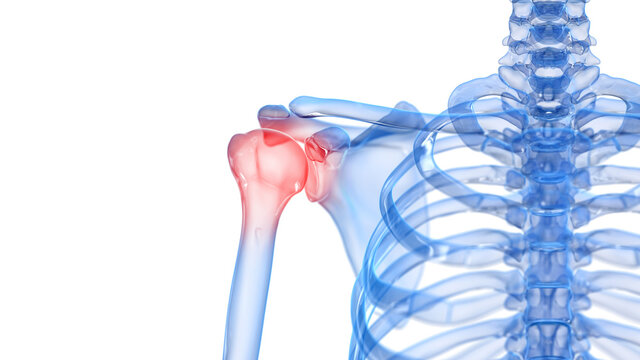 3d rendered illustration of a painful shoulder