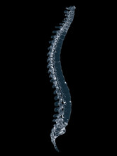 3d Rendered Illustration Of A Glass Spine