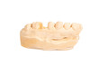 Plaster model of a part of a human jaw. Dental prosthesis from  gypsum model.
Plaster model of teeth.