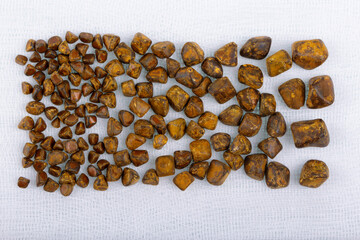 Cholelithiasis, gallbladder stones laid out in size after a successful cholecystectomy