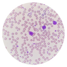 Peripheral Blood Showing Mast Cell And Two Monocyte. Leukocyte With A Large Round Nucleus And Numerous Dark Purple Or Blue Cytoplasmic Granules, Mast Cell.