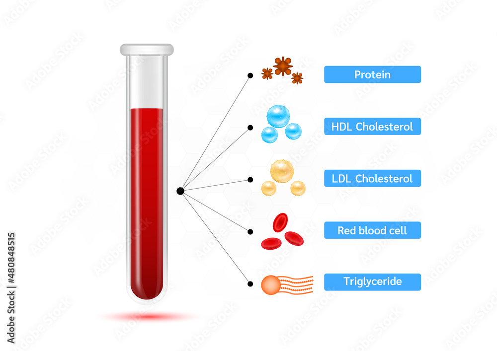 Ldl Test Medical blood test cholesterol in test tube. cholesterol meter scale ...