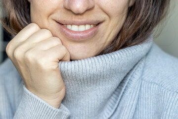 close up of woman's mouth and teeth, smiling and holding the hand under de chin. girl in grey wool sweater. comfy clothes for winter, christmas mood. white beautiful big front teeth.