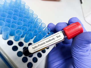 Poster - Scientist hold blood sample for COVID-19 spike protein test, COVID-19 IgG antibody test, after vaccination, tips holder with tips background