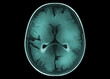 Scan of human brain on black background, illustration