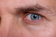 © malija - Man with blue eyes and a corrective contact lens.