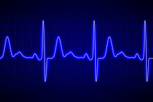 Heart Beat Ecg Or Ekg Seamless Neon Line On Blue Background. Electrocardiogram Graph Of Healsh Cardio Rate. Examination Of Human Health. Medicine Test Cardiac Rhythm And Pulsating Inteval.