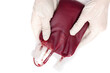 A doctor in latex gloves holding a blood bag.  Blood transfusion and blood donation concept.