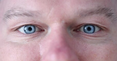 Poster - Blue eyes are dilation of pupil of young man closeup