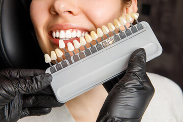 Wall Mural - Smiling young woman. Cosmetological teeth whitening in a dental clinic. selection of the tone of the implant tooth