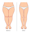Woman legs weight loss vector illustration. Before and after. 