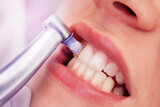 Fototapeta  - Close-up professionelle Zahnreinigung / die Zähne einer Frau werden poliert
