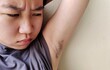 © Rung Kh - portrait of a teenage showing the armpit hair, facial expressions and worry, concept health care.